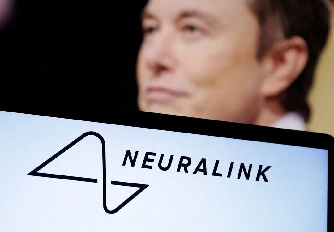Brainwaves and Buzz: Elon Musk's Neuralink Implant – Science Fiction or Future Fact?